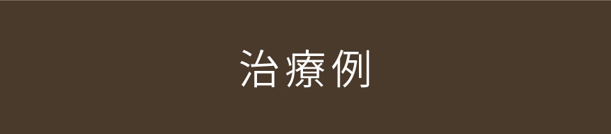 治療例